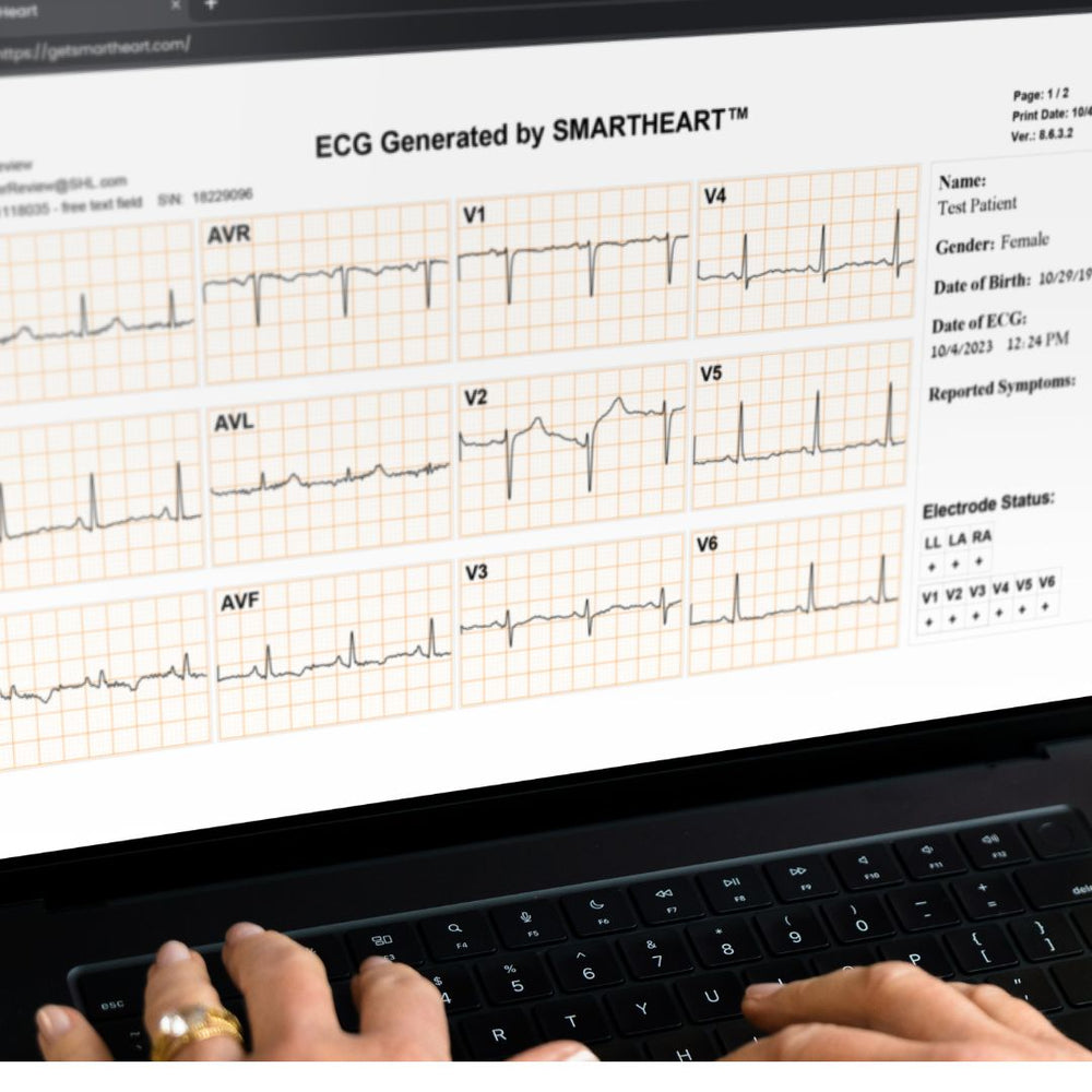 Ecg Scan Why Every Doctor Needs a Portable EKG for Early Diagnosis – SmartHeart