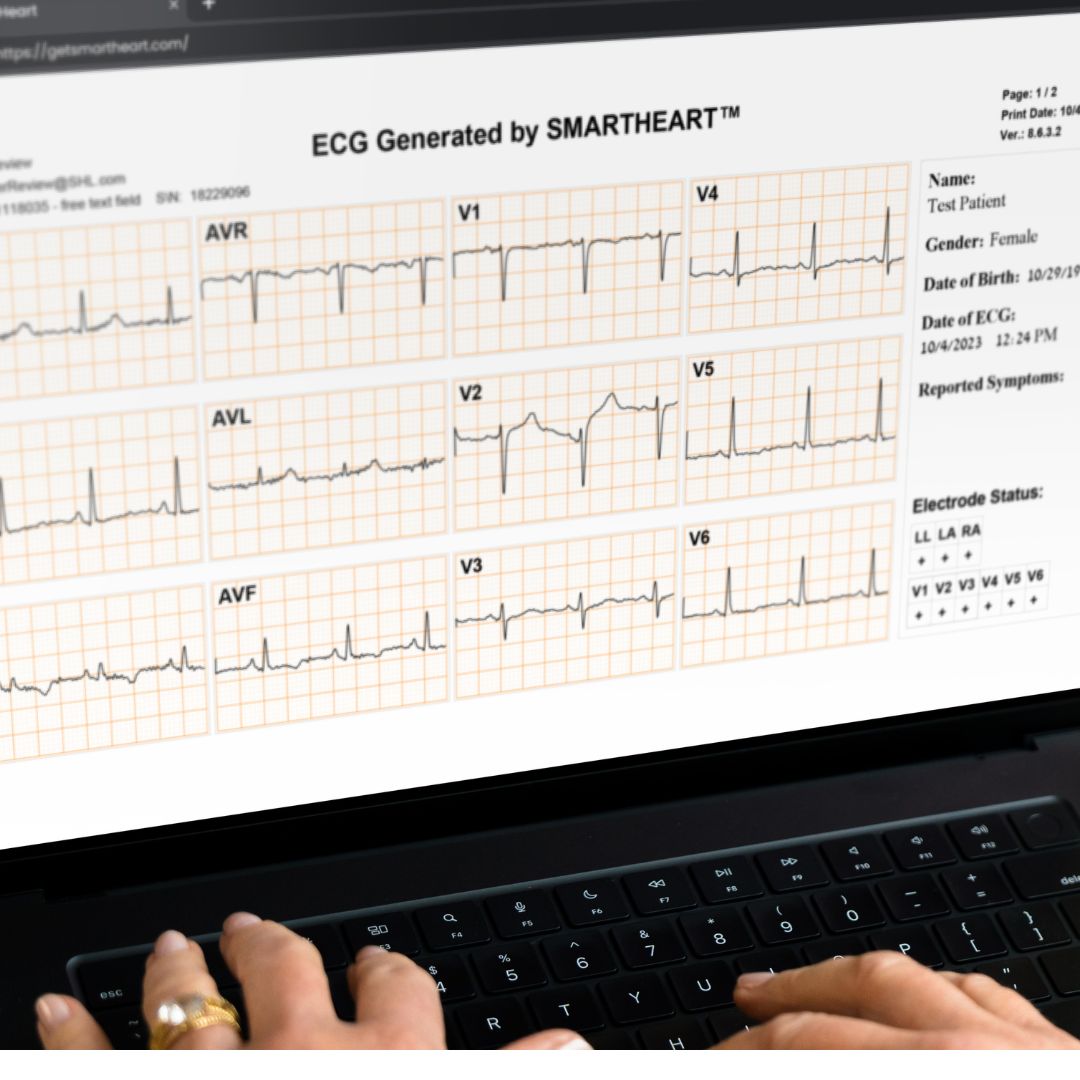 ECG results