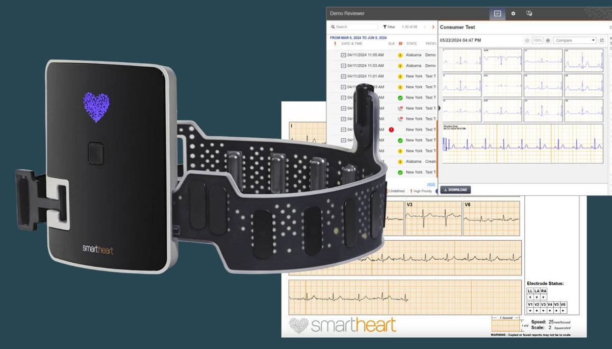 SmartHeart device next to the Clinical Care Platform showing a 12-lead EKG report